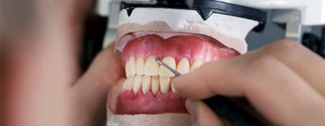 Lab technician’s hand putting the final touches on dentures