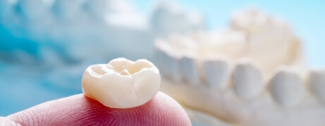 Dental crown resting on a finger